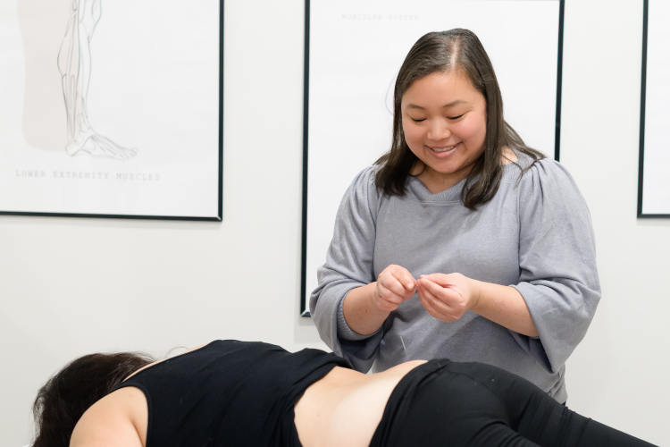 Close-up of acupuncture treatment showing thin needles placed on a patient's back